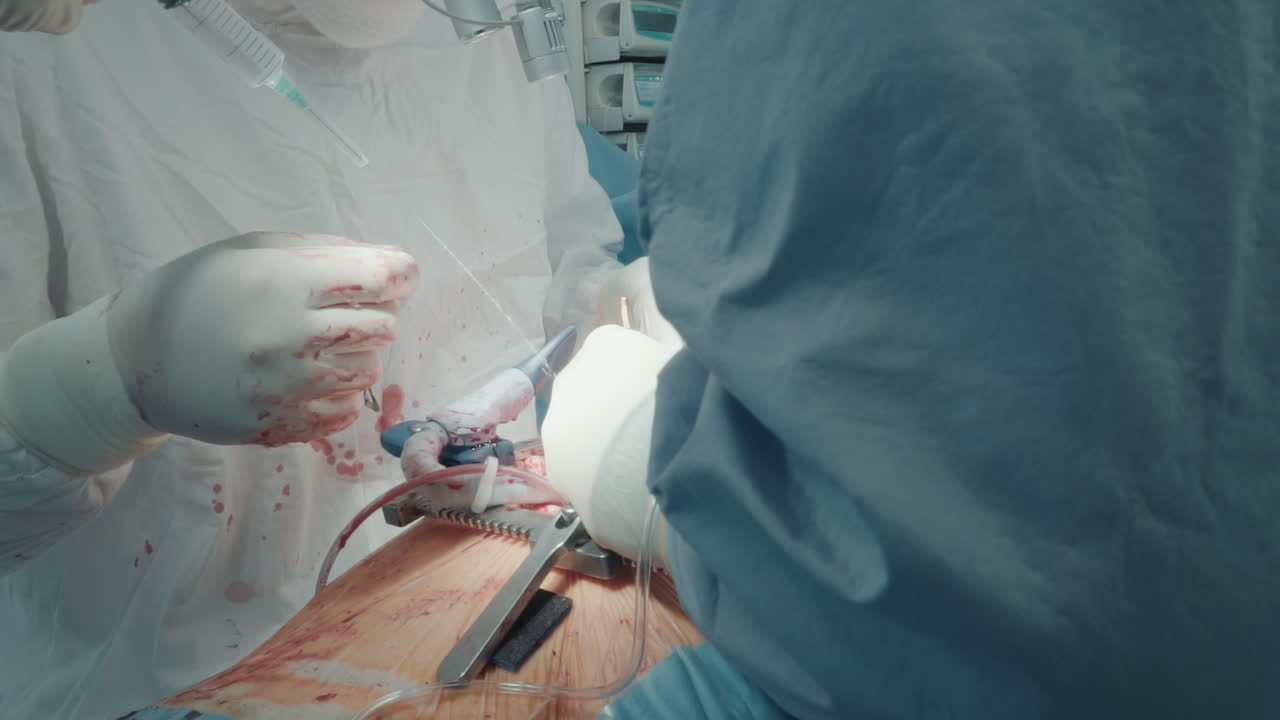 조교는 심장에 용액을 뿌립니다. 팀은 수술 현장을 청소하기 위해 액체를 사용합니다. 클리닉에서 수술하는 동안 외과 의사에게 좋은 가시성을 보장합니다.