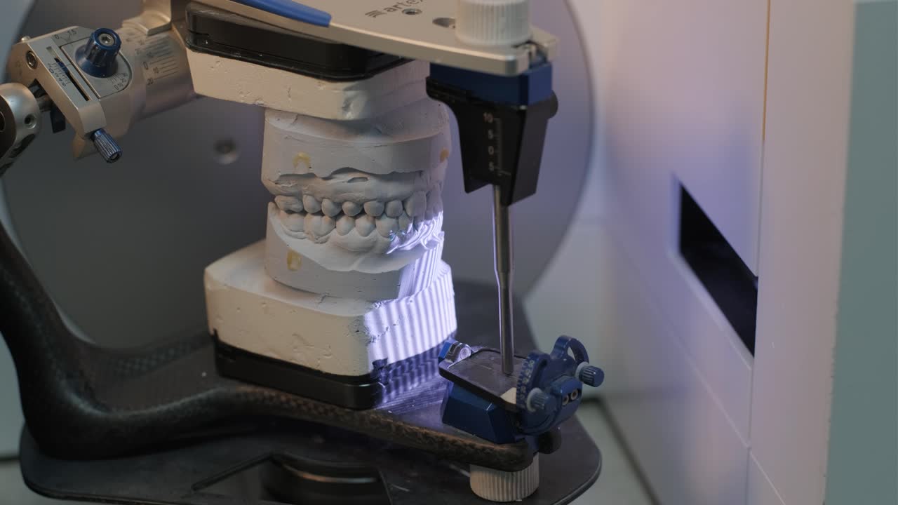 escáner dental 3d que captura el modelo de prótesis de arco completo