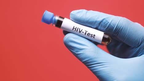 hiv test in a test tube