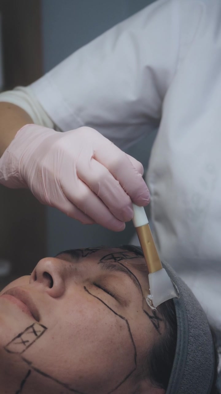 Cosmetologo che applica del gel sul viso di una paziente per un trattamento estetico.