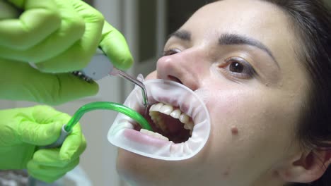 Mujer-Joven-Con-Expansor-En-Boca-En-La-Clínica-Dental.-Limpiar-Los-Dientes-Con-Agua.-Consultorio-Dental-Moderno.-Dentista-Usando