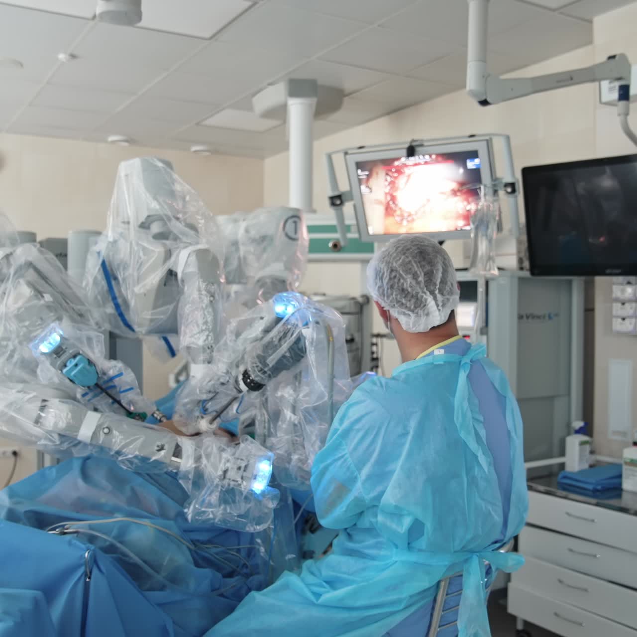 Robotic surgery in hospital. Medical team performing operation in the surgery room in hospital