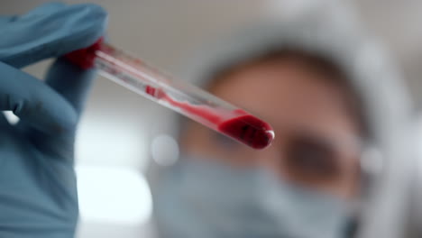 técnico de mão segurando tubo de ensaio com sangue. médico examinando amostra de sangue