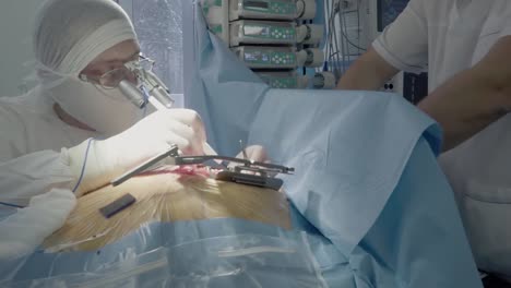 medical staff during the operation work of a cardiac surgeon