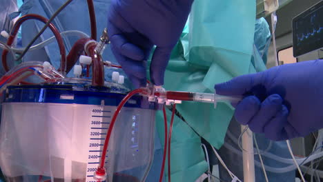 cardiopulmonary bypass procedure