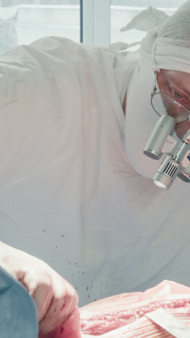 el cirujano utiliza un dispositivo de electrocauterización. el médico con binoculares maneja el equipo para la coagulación de los vasos sanguíneos para controlar y detener el sangrado después de la cirugía