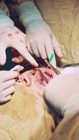 surgery team operating