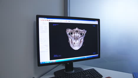 computer displaying 3d model of a fractured jaw