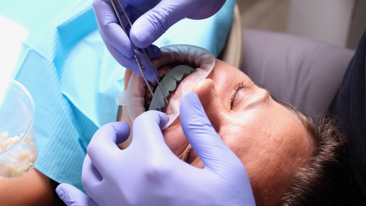 Dental Procedure: Professional Working on Patient's Teeth