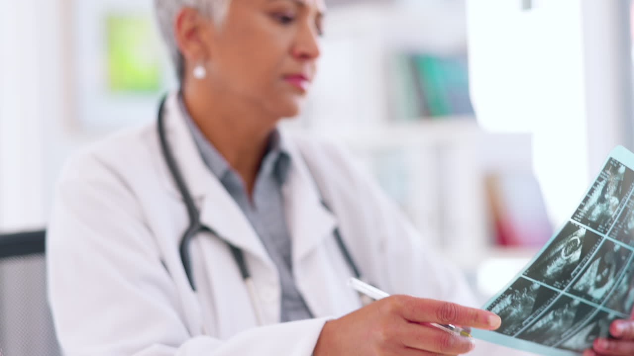 mujer, médico o cuaderno escribiendo para radiografías