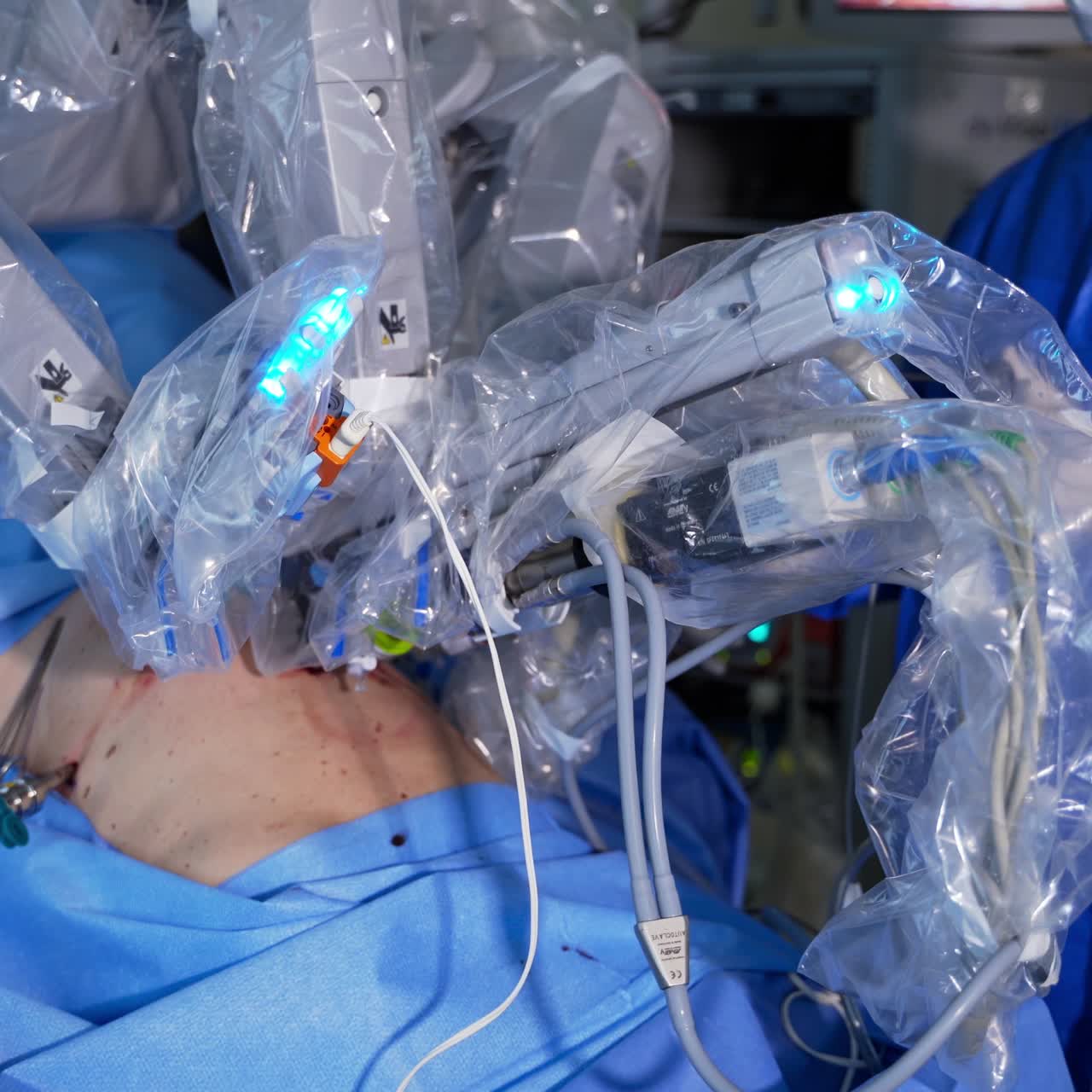 Futuristic surgery equipment operating the patient. Robotic arm moving slowly during the surgery. Surgeon standing behind the operating table