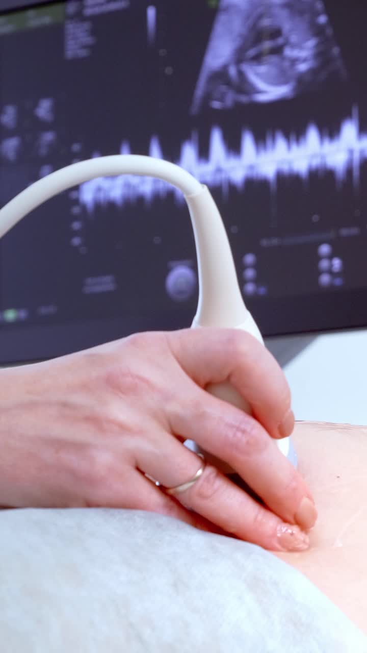 Profissional de saúde usando aparelho de ultrassom em paciente com monitor exibindo os resultados.