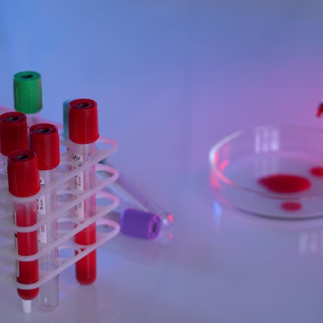laboratory blood tests
