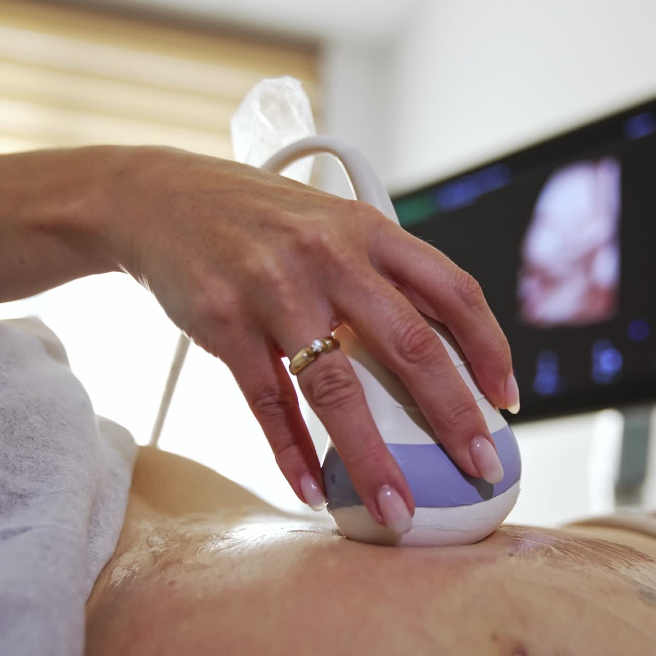 Medic's hand moving the transducer by the big female belly. Ultrasound check for a pregnant lady at the last stages of baby carrying. Close up
