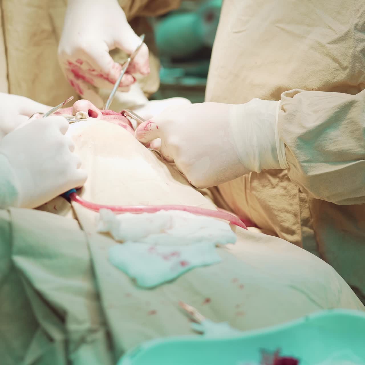 Modern Hospital Operating Room