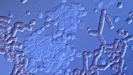 microscopic view of red blood cells and rouleaux formation