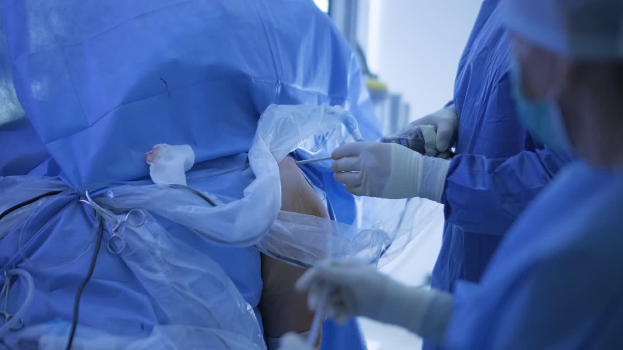 A detailed image depicting a shoulder arthroscopy procedure. A surgeon is using a tiny camera, known as an arthroscope, inserted through a small incision to examine and repair tissues inside the shoulder joint.