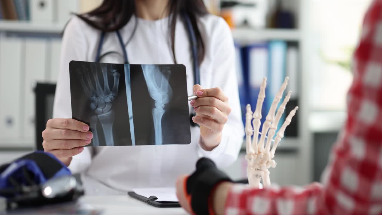 Doctors point to xray medical imaging with hand bone disease