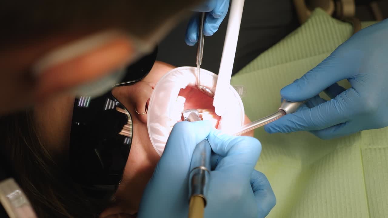 proceso de retiro de brackets