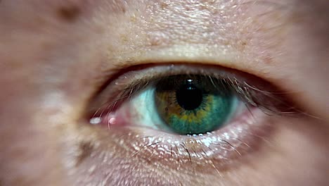 primer plano del inusual ojo de dos tonos de un macho blanco