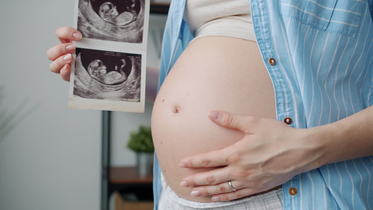 mujer embarazada con una imagen de ultrasonido