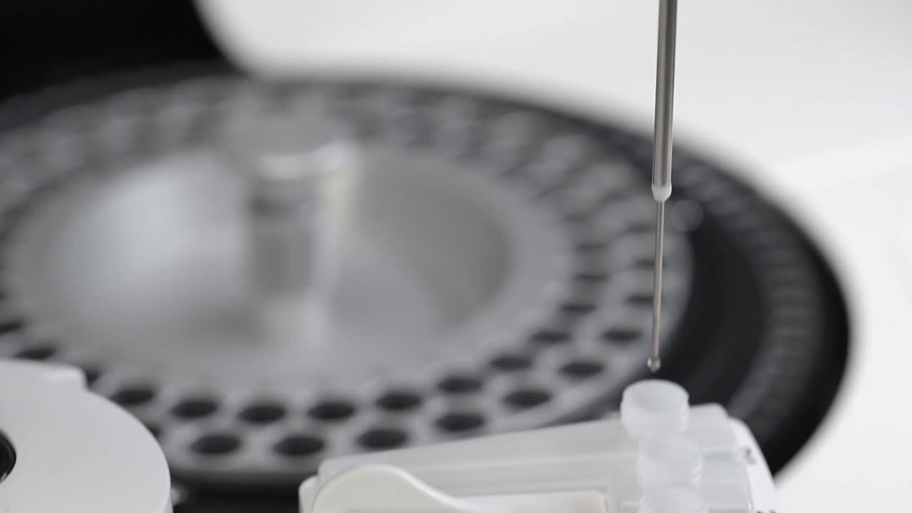 맥로 클로즈업  ⁇ 트 다운 혈액의 일부 cbc 기계의  ⁇