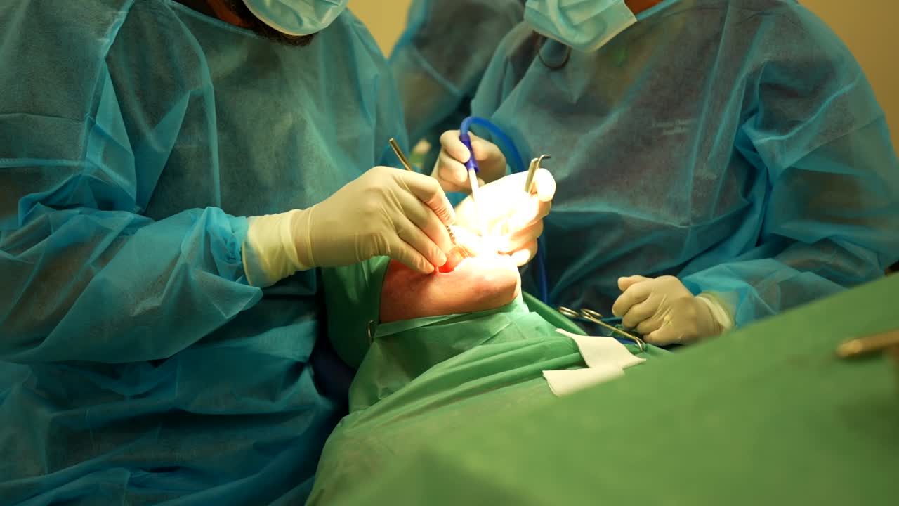Professionisti medici che eseguono un intervento di chirurgia orale o dentale.
