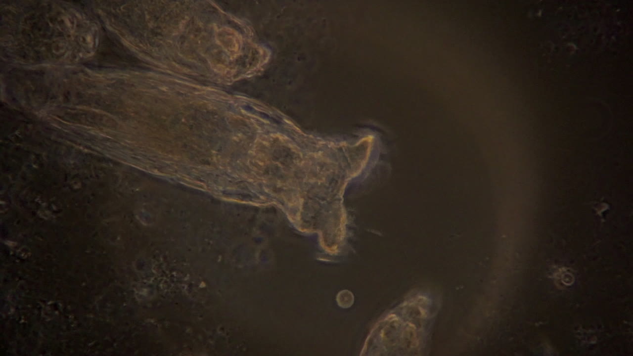 una vista microscópica de rotíferos en iluminación de contraste de fase