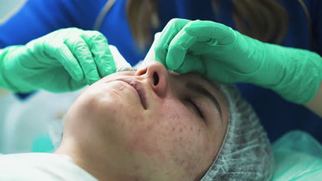 careful beautician squishes pimples on woman face in clinic