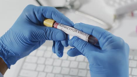 Hands-of-doctor-holding-vial-with-monkeypox-virus-over-keyboard