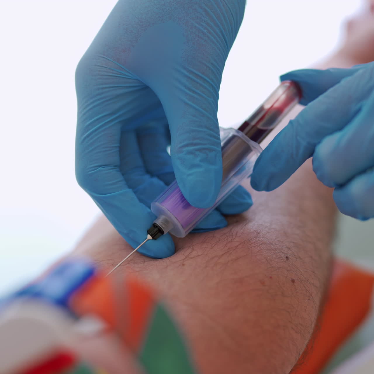 Close-up view of a needle on man's arm to collect blood into syringe. Medical worker in gloves taking blood sample from vein.