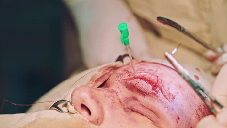 surgery team operating