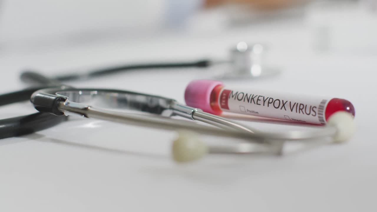Close up of vials with monkeypox virus and stethoscope