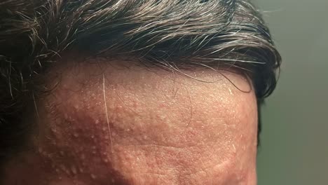 close-up of a furrowed forehead, showing worry in soft lighting