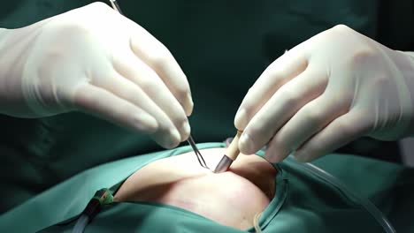 surgeons in a medical facility focus intently while performing a delicate surgical procedure on a patient. precision and expertise are essential in this setting.