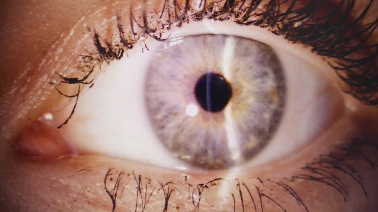 Close-up of Woman's Eye During Retina Examination