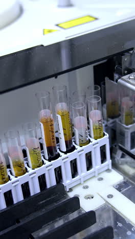 test glasses with handwritten marks on them placed into special holder in machine. blood test performance in the laboratory with advanced equipment. vertical video