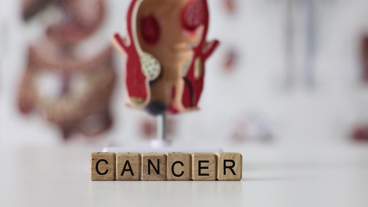 La parola 'cancro' costruita con cubi di legno sullo sfondo di un modello di retto