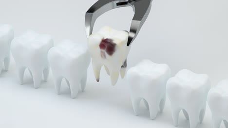 animation of removing the sick tooth, 3d rendering.