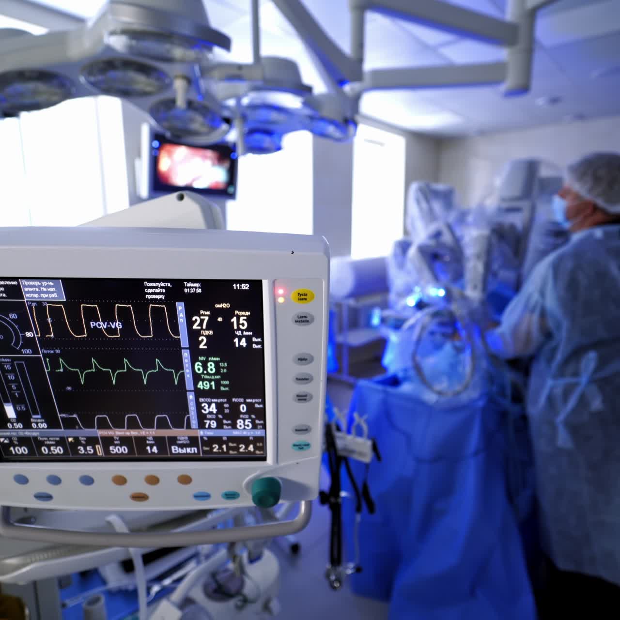 Graphs on the screen of medical monitor. Surgical room with medical equipment during operation. Heart rate monitor on surgical process background.