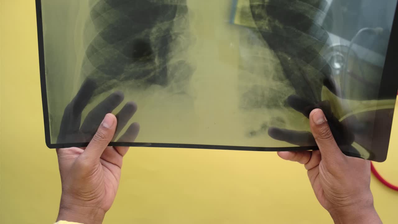 Chest X-Ray Examination