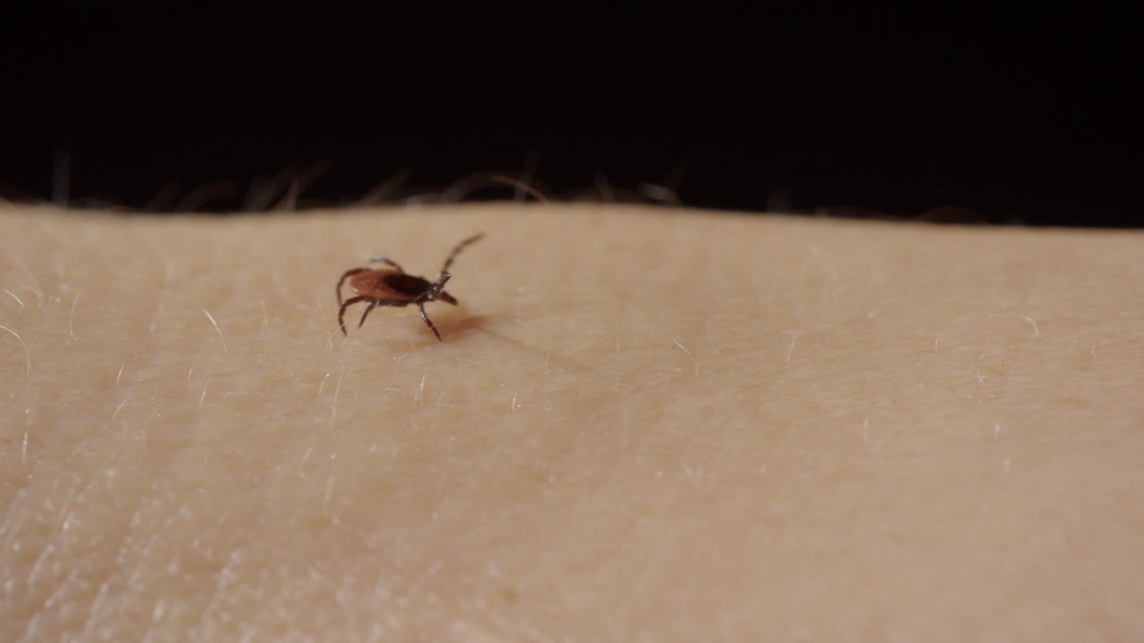 Parasitic tick walks awkwardly over human skin with front legs up