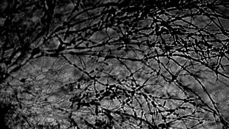 microscopic timelapse of mushroom fungus mycelium strands growing across screen