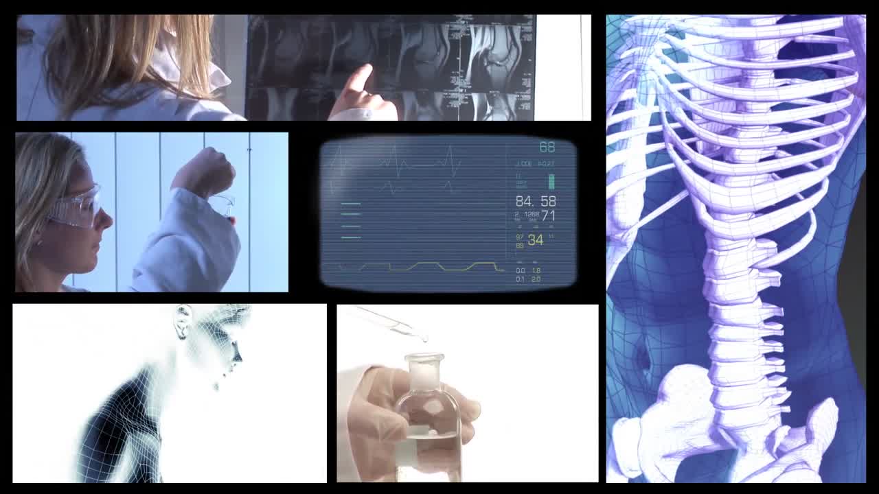 의료 비디오 몬태지