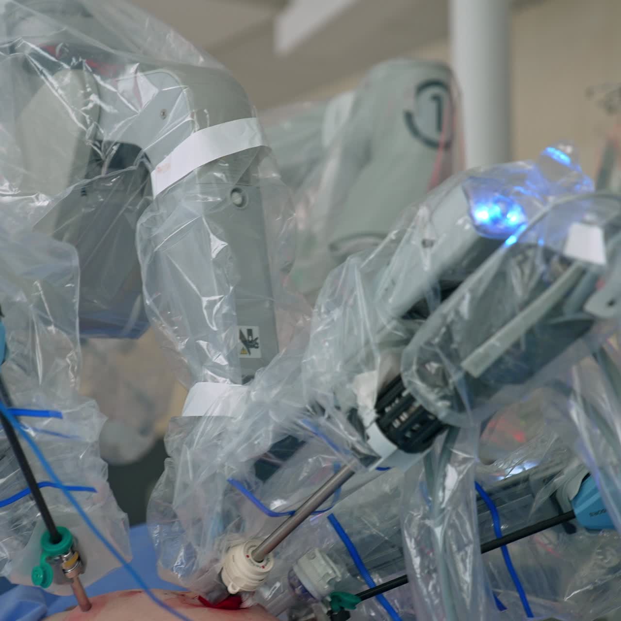 Handsome young male doctor in mask, cap and protective clothes looking intently in front of him. Da Vinci robotic arms moving in the patient's body near the surgeon