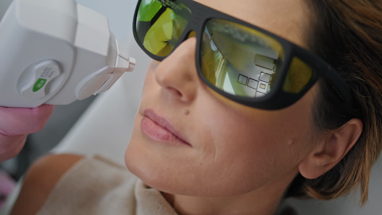 moderna procedura di cura della pelle con laser per il ringiovanimento del viso in un salone di bellezza da vicino
