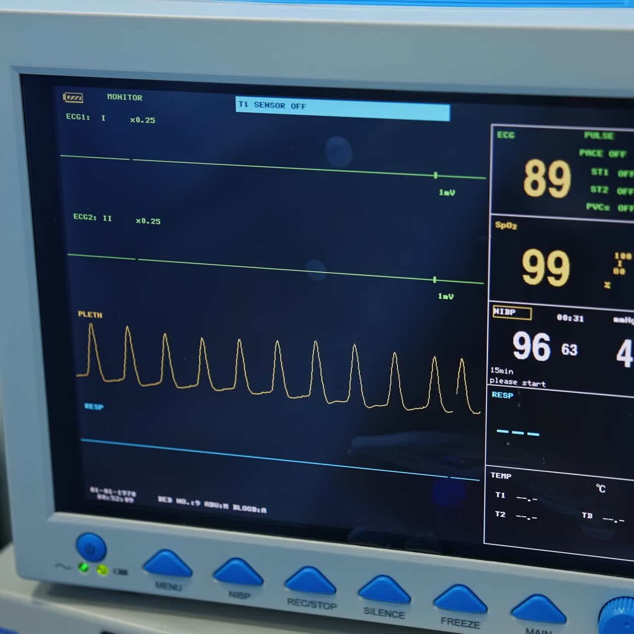 Patient's life parameters on the black screen of monitor. Close up. Equipment for checking the condition of the person under surgery