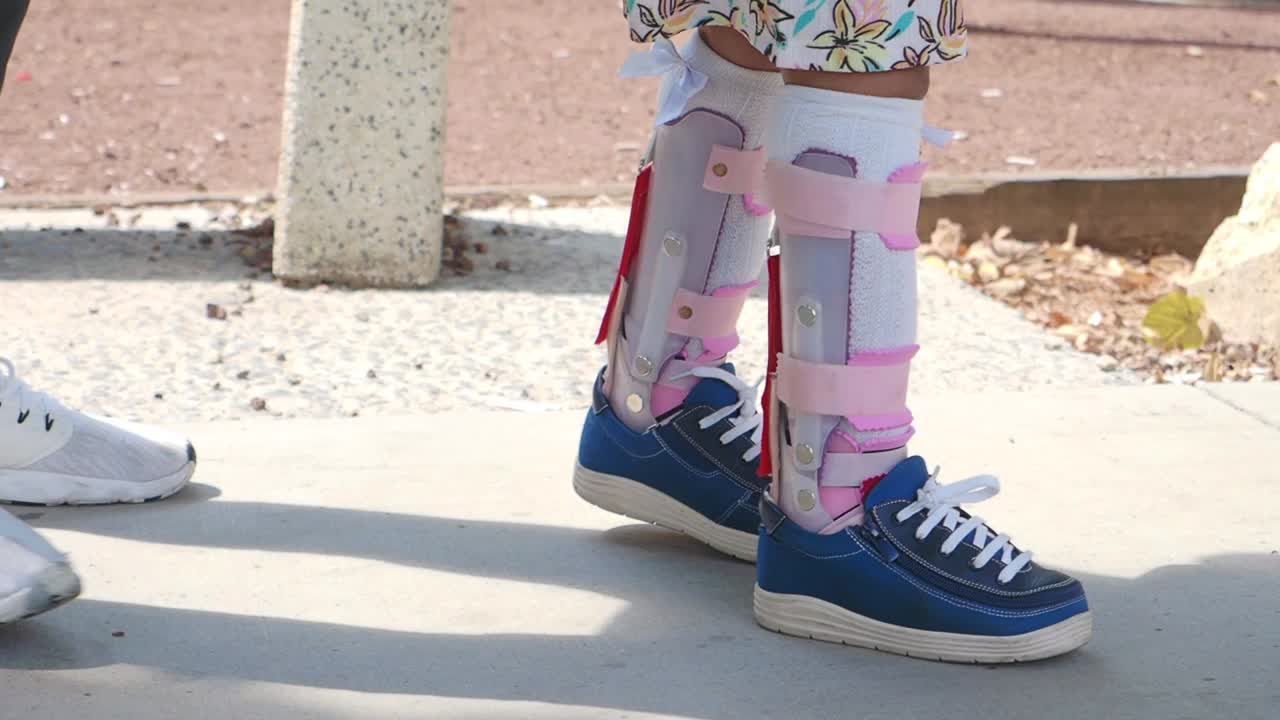 niño con aparatos ortopédicos para las piernas