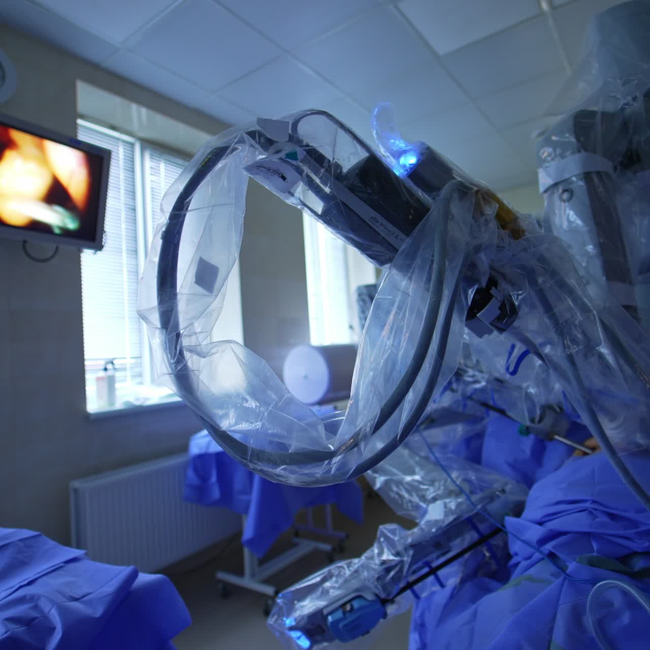 Surgical Da Vinci robot operating the patient. Robotic arms moving at operative field over the patient. Screen on the wall shows the surgery