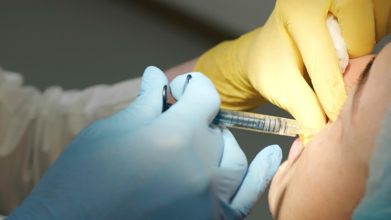 procedimiento de rejuvenecimiento conocido como terapia botulínica, con una inyección en la cara.